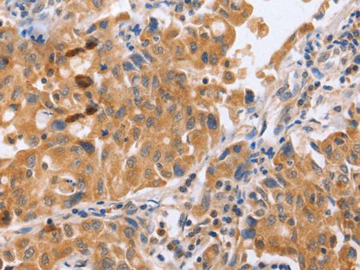 BLNK Polyclonal Antibody Store at -20°C Host Rabbit