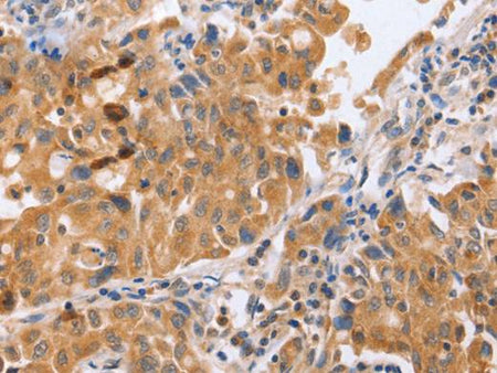 BLNK Polyclonal Antibody Store at -20°C Host Rabbit