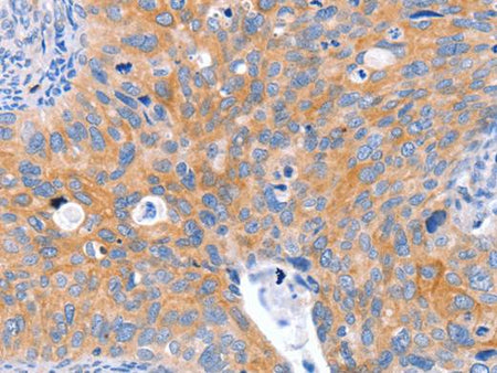 ABO Polyclonal Antibody Store at -20°C Host Rabbit