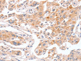 ABO Polyclonal Antibody Store at -20°C Host Rabbit