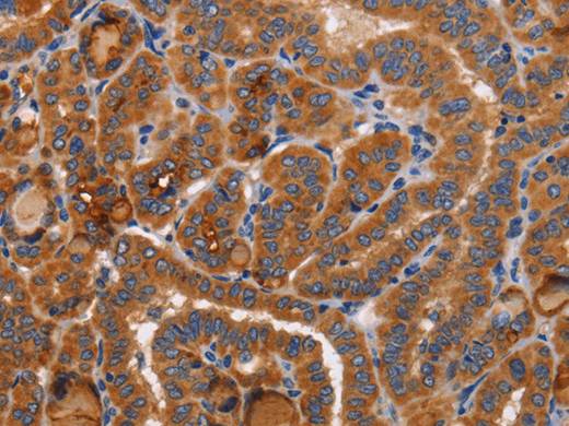 BMP6 Polyclonal Antibody Store at -20°C Host Rabbit