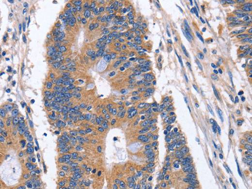 BMP6 Polyclonal Antibody Store at -20°C Host Rabbit