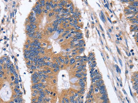 BMP6 Polyclonal Antibody Store at -20°C Host Rabbit