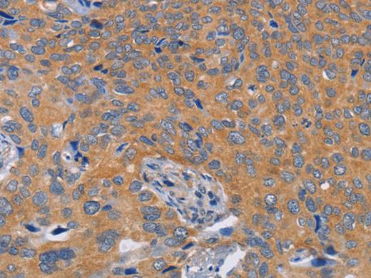 BOD1 Polyclonal Antibody