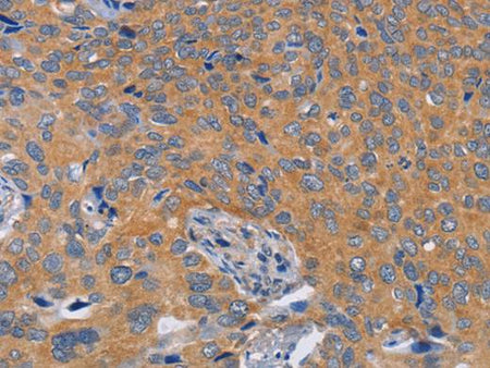 BOD1 Polyclonal Antibody