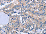 BOD1 Polyclonal Antibody