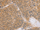 BRS3 Polyclonal Antibody