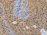 BRS3 Polyclonal Antibody