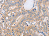 BST1 Polyclonal Antibody