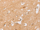BST1 Polyclonal Antibody