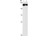 CBL Polyclonal Antibody Store at -20°C Host Rabbit