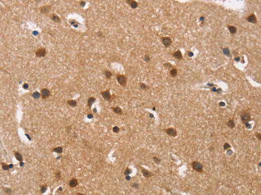 Cav1.3 Polyclonal Antibody