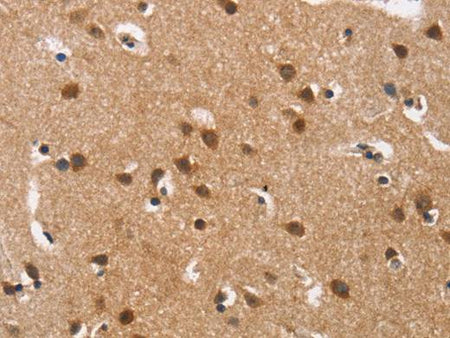 Cav1.3 Polyclonal Antibody