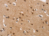 Cav1.3 Polyclonal Antibody
