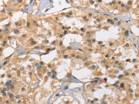 Cav1.3 Polyclonal Antibody