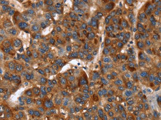 CACNB2 Polyclonal Antibody