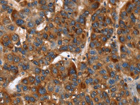 CACNB2 Polyclonal Antibody