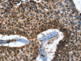 CACNB2 Polyclonal Antibody