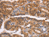 NCAPG2 Polyclonal Antibody