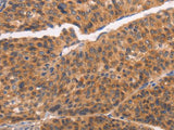 NCAPG2 Polyclonal Antibody