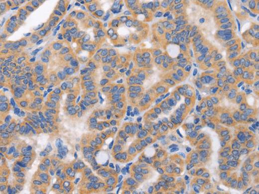 CARD17 Polyclonal Antibody