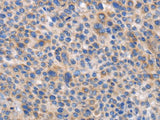 CARD17 Polyclonal Antibody
