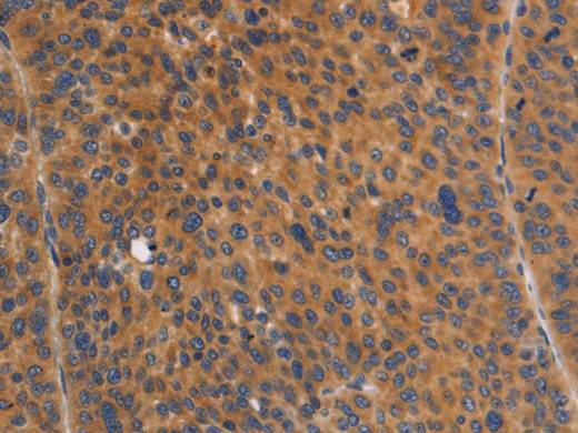 NOD1 Polyclonal Antibody Store at -20°C Host Rabbit