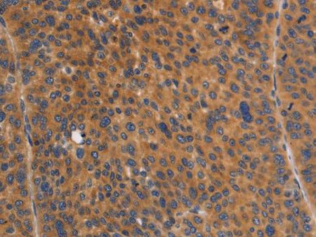 NOD1 Polyclonal Antibody Store at -20°C Host Rabbit