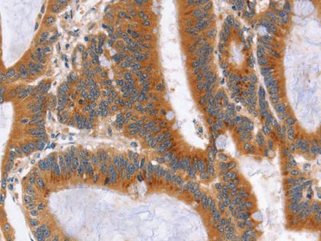 NOD1 Polyclonal Antibody Store at -20°C Host Rabbit