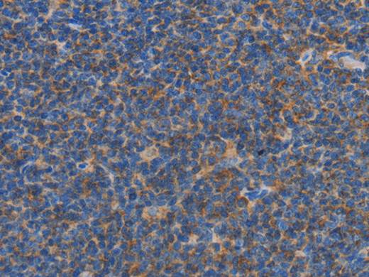 CARD6 Polyclonal Antibody Store at -20°C Host Rabbit
