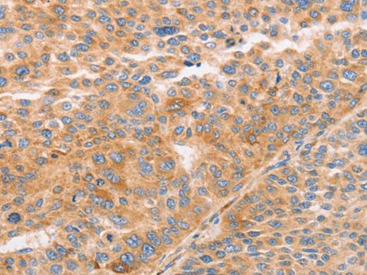 STK4 Polyclonal Antibody Store at -20°C Host Rabbit