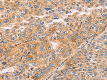STK4 Polyclonal Antibody Store at -20°C Host Rabbit