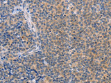 CCL16 Polyclonal Antibody Store at -20°C Host Rabbit