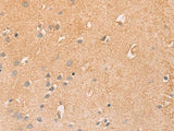 CCL16 Polyclonal Antibody Store at -20°C Host Rabbit