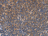CCL23 Polyclonal Antibody