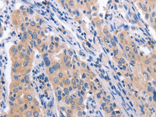 CCL23 Polyclonal Antibody