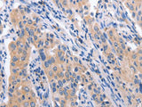 CCL23 Polyclonal Antibody