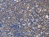 CCR6 Polyclonal Antibody Store at -20°C Host Rabbit