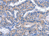 CCR6 Polyclonal Antibody Store at -20°C Host Rabbit