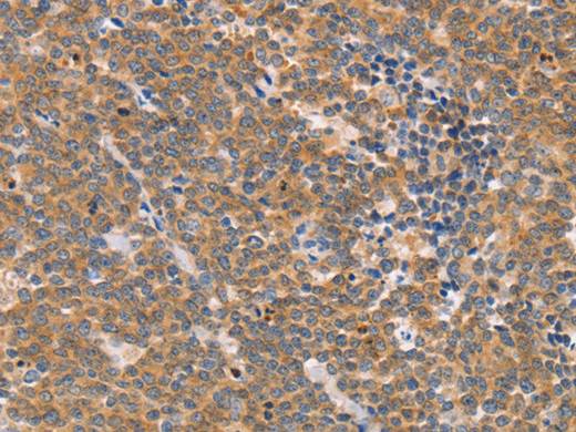 CD2AP Polyclonal Antibody