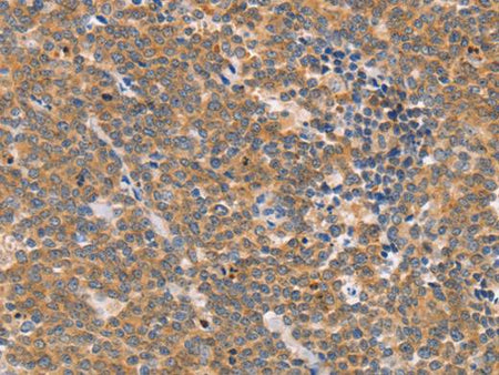 CD2AP Polyclonal Antibody