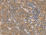 CD2AP Polyclonal Antibody