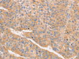CD2AP Polyclonal Antibody