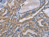 TNFRSF8 Polyclonal Antibody Store at -20°C Host Rabbit
