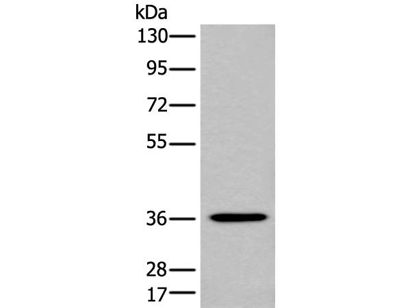 NCR1 Polyclonal Antibody Store at -20°C Host Rabbit