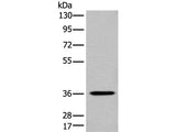 NCR1 Polyclonal Antibody Store at -20°C Host Rabbit