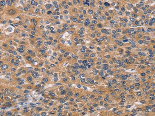 NCR2 Polyclonal Antibody Store at -20°C Host Rabbit