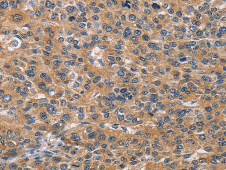 NCR2 Polyclonal Antibody Store at -20°C Host Rabbit