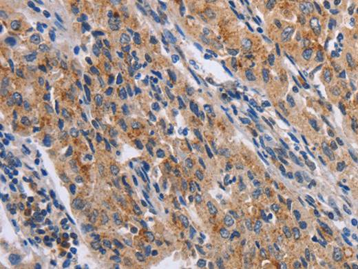 NCR2 Polyclonal Antibody Store at -20°C Host Rabbit