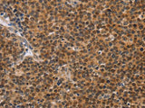 CD36 Polyclonal Antibody Store at -20°C Host Rabbit
